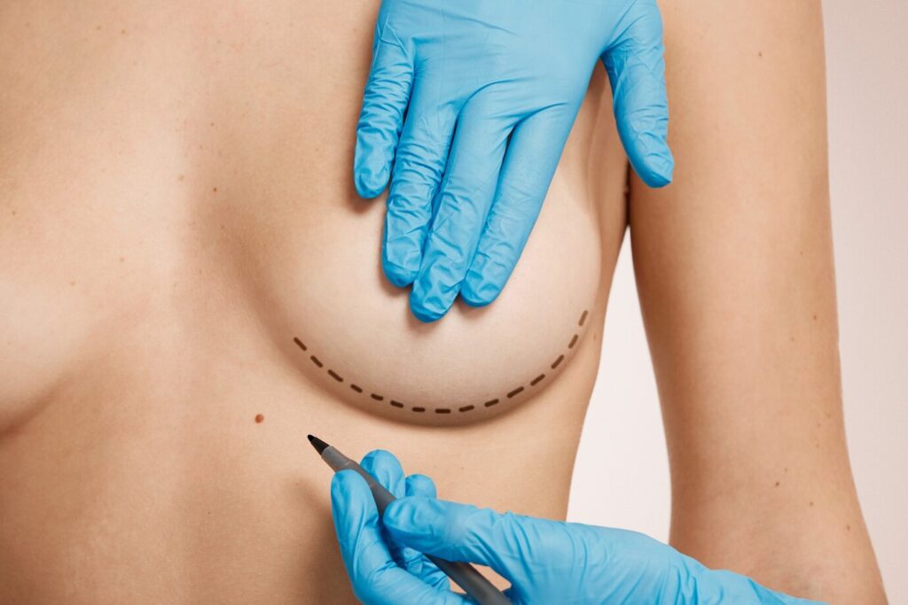 Breast Reduction Surgery in Karnal