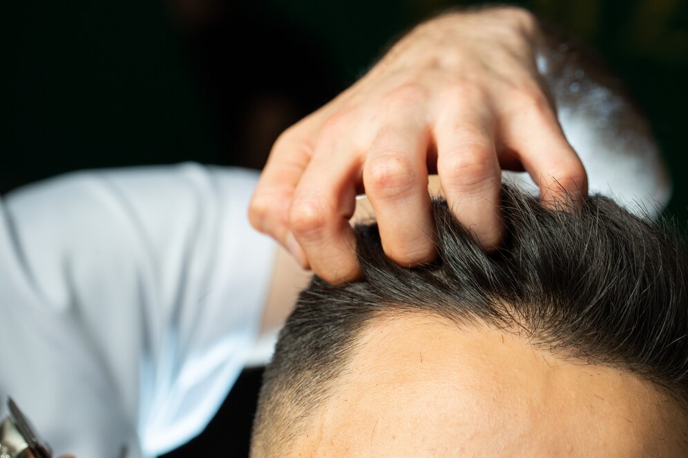 Hair Transplant in Karnal