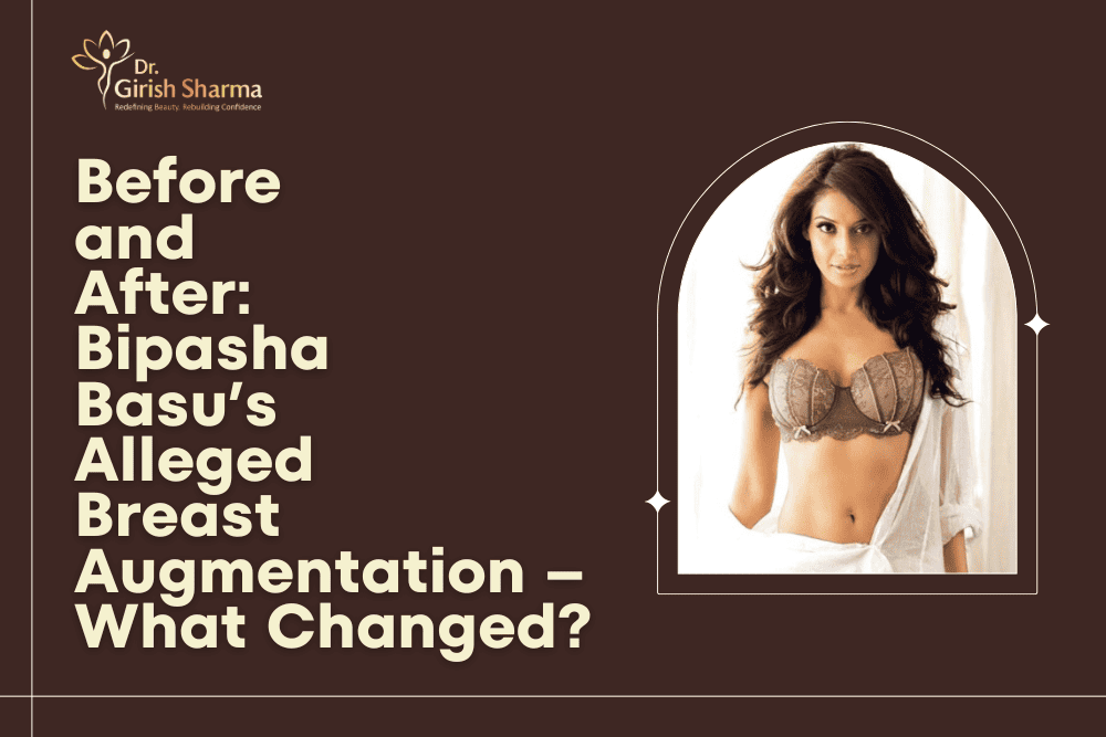 Before and After: Bipasha Basu’s Alleged Breast Augmentation – What Changed?