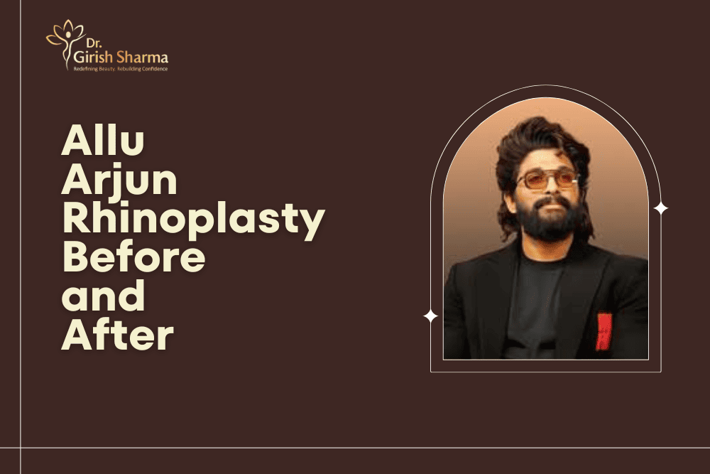 Allu Arjun Rhinoplasty Before and After