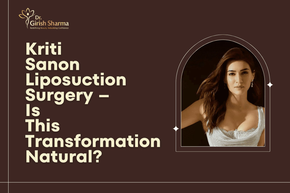 Kriti Sanon Liposuction Surgery – Is This Transformation Natural?