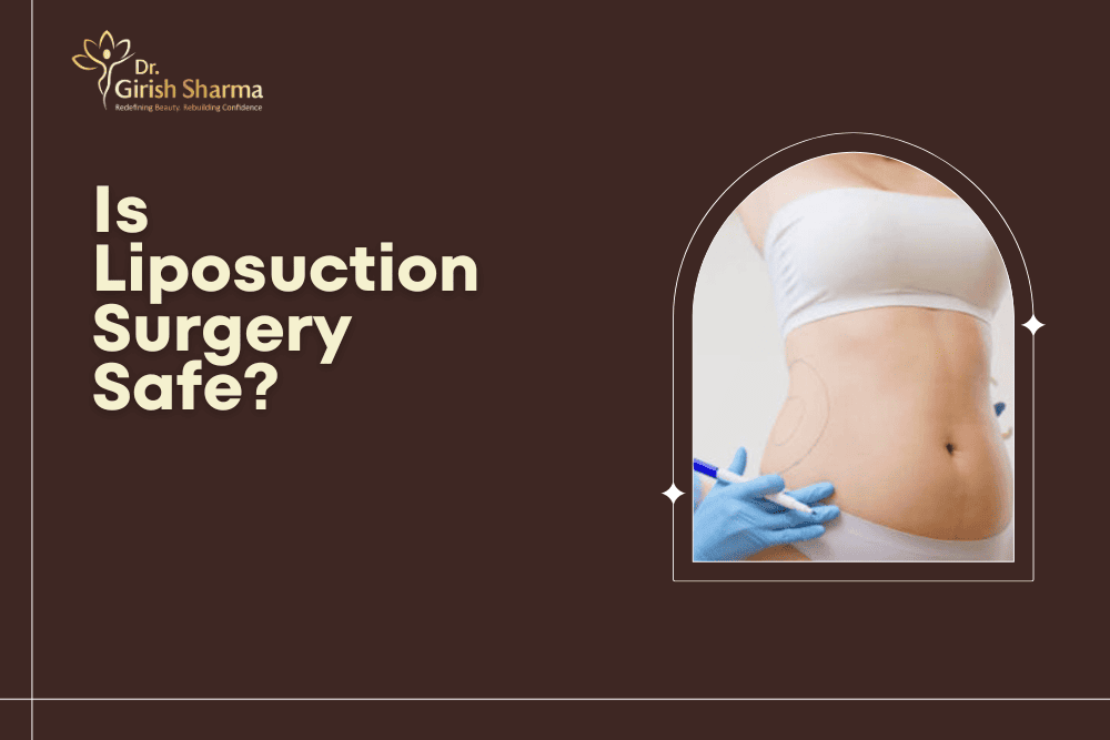 Is Liposuction Surgery Safe?