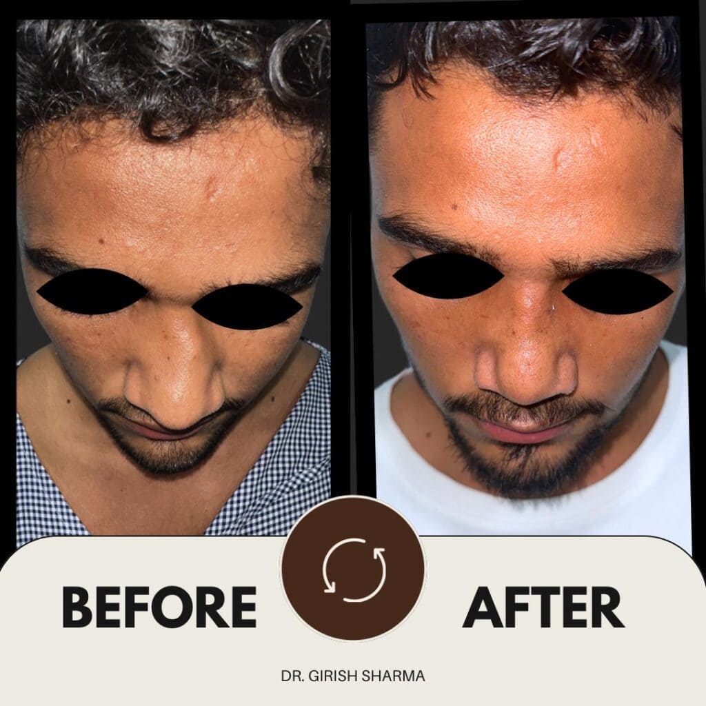 Best Plastic Surgeon in Karnal