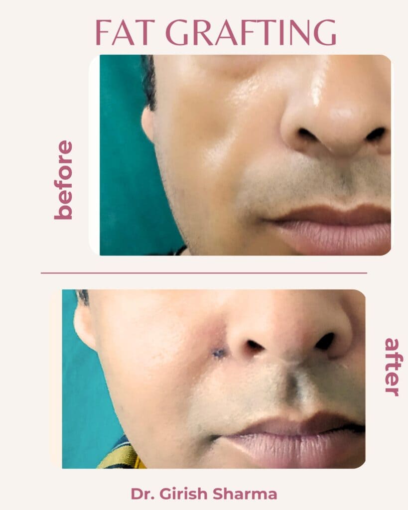 Best Plastic Surgeon in Karnal