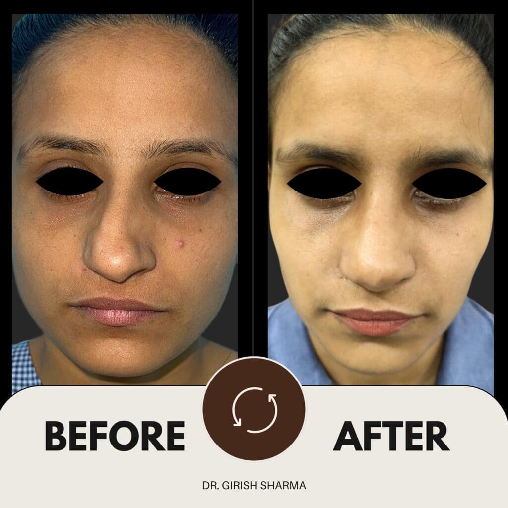 Best Plastic Surgeon in Karnal