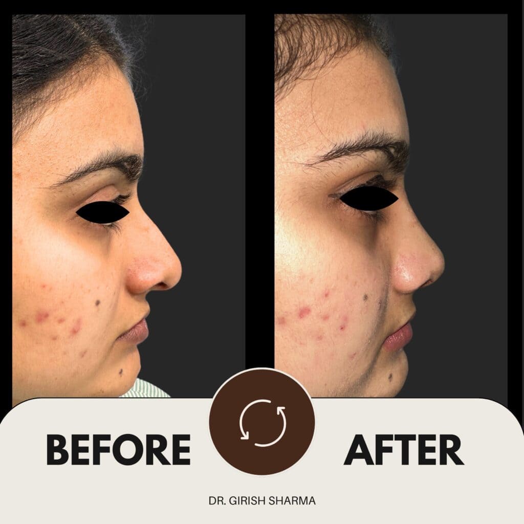 Best Plastic Surgeon in Karnal