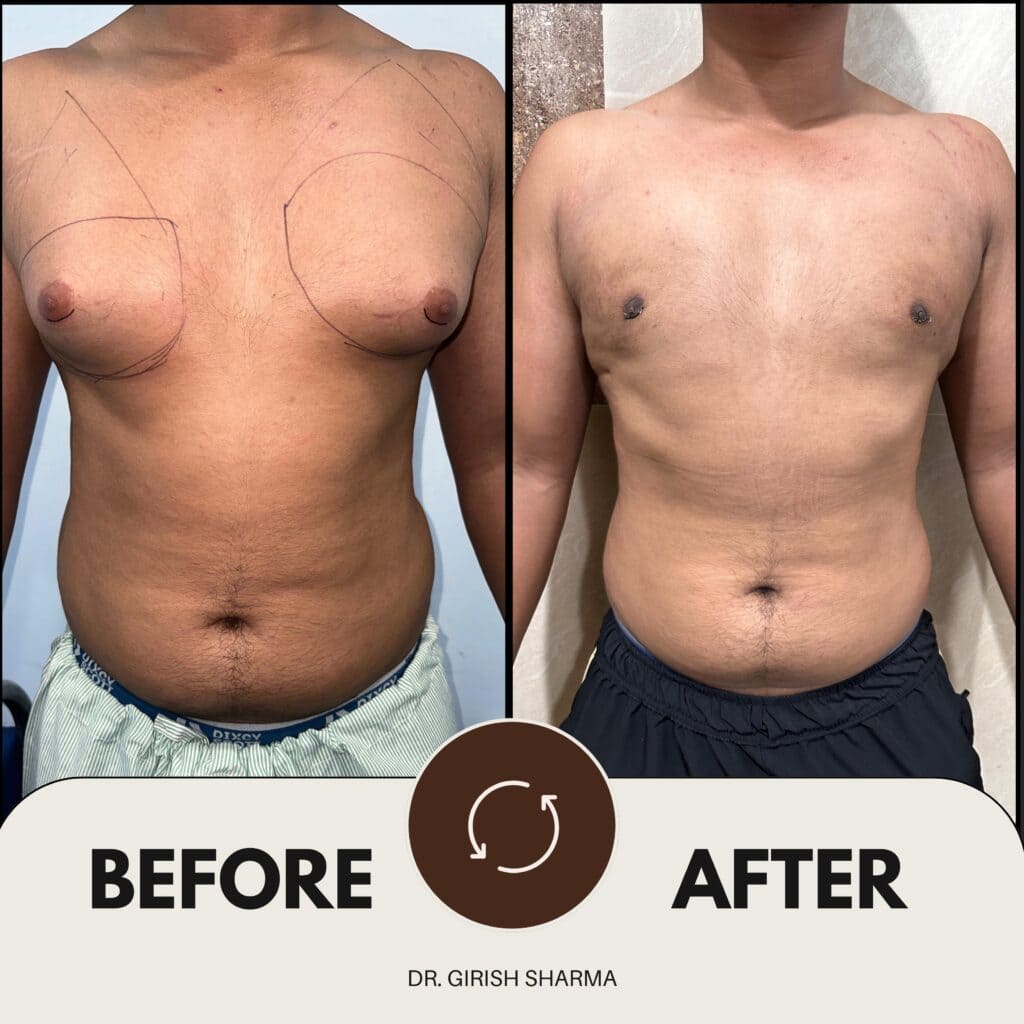 Best Plastic Surgeon in Karnal