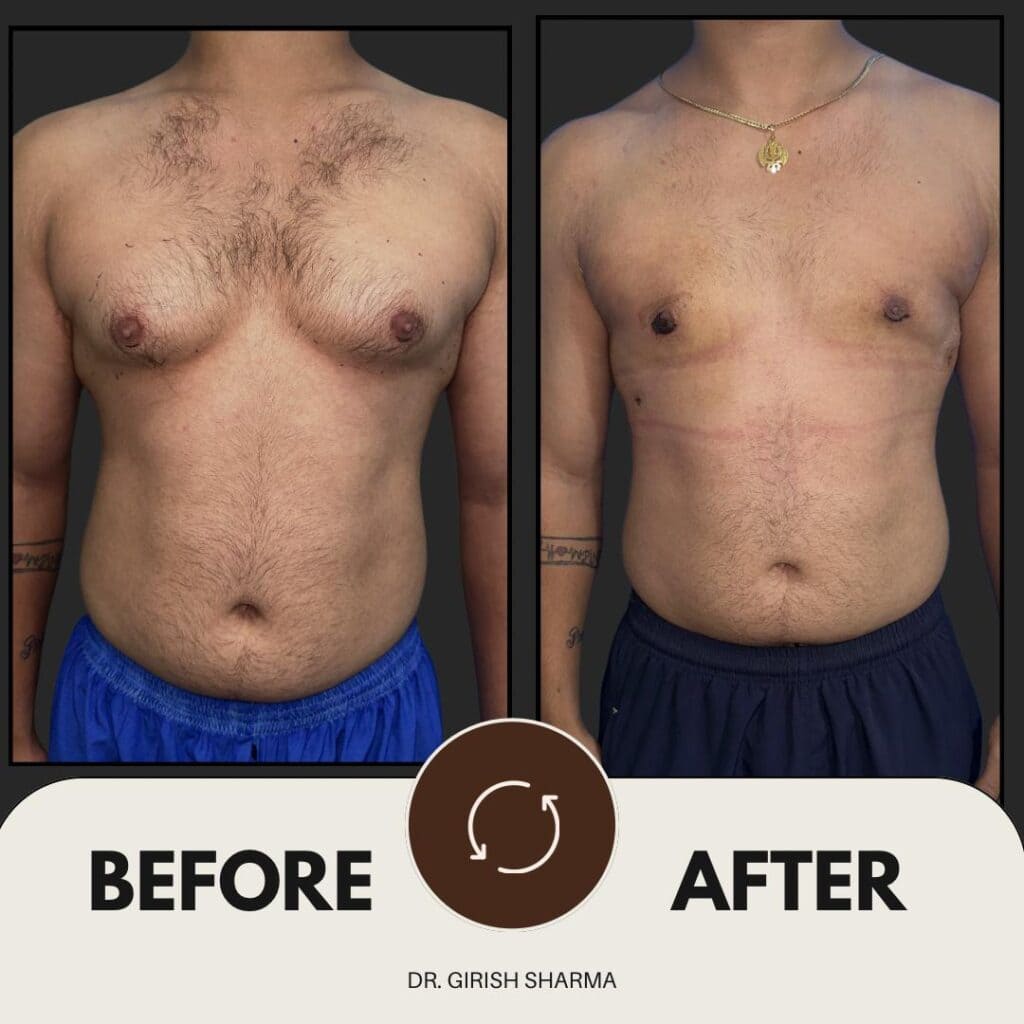 Best Plastic Surgeon in Karnal