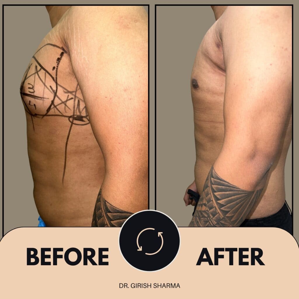 Best Plastic Surgeon in Karnal