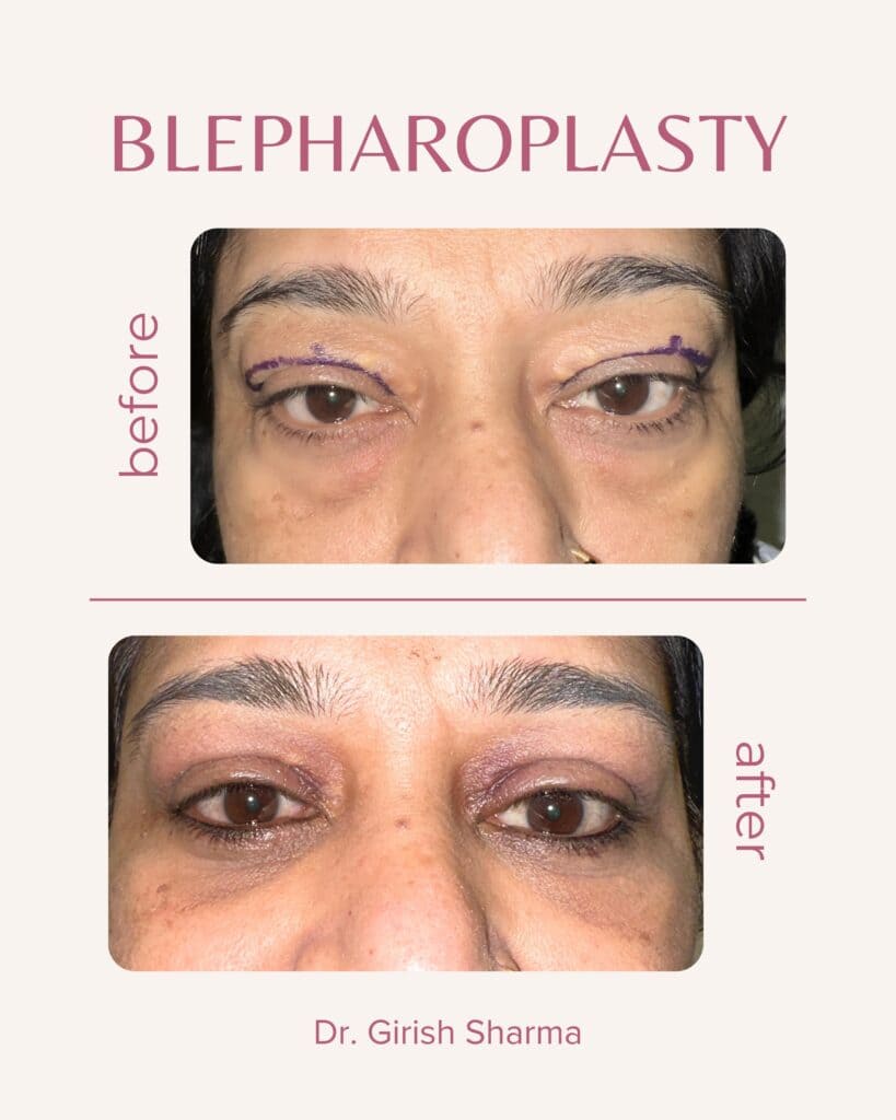 Best Plastic Surgeon in Karnal