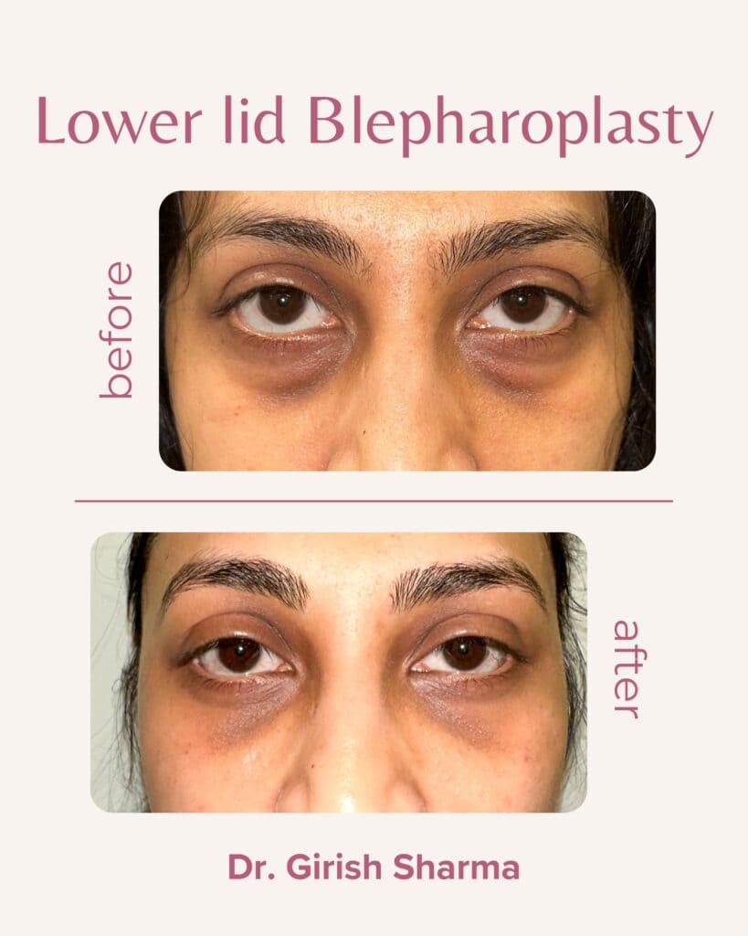 Best Plastic Surgeon in Karnal